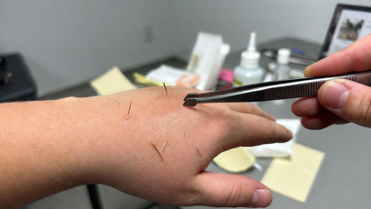 First aid steps for removing cactus spines from skin safely